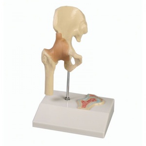 Miniature Hip Joint with Cross-Section
